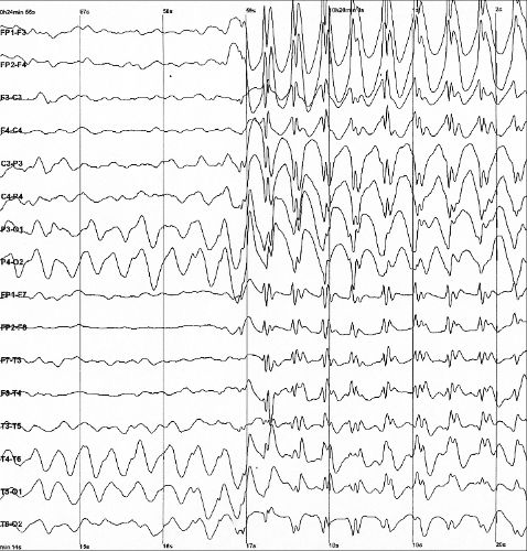 Brain waves of rats
